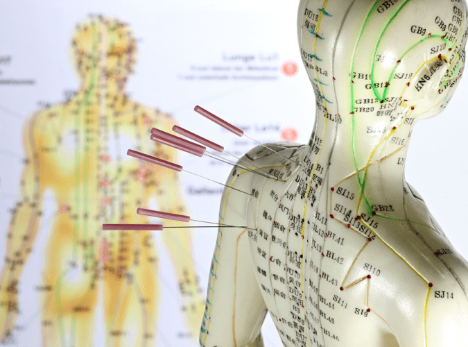 Acupuncture Treatment Img